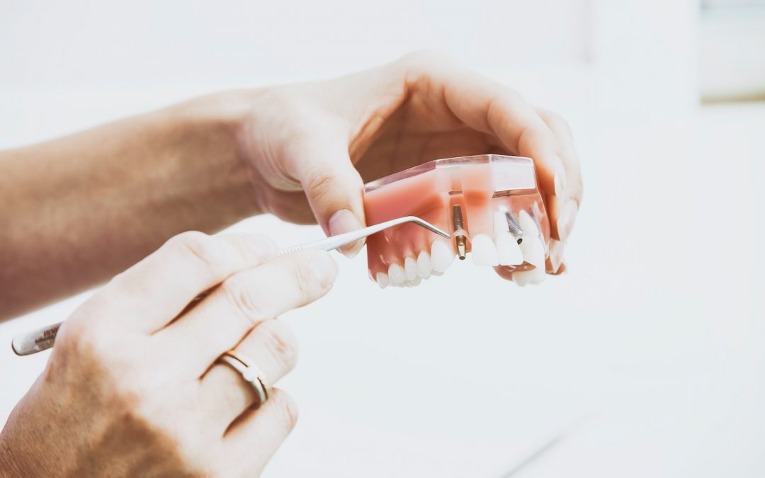 person wearing silver-colored ring while holding denture