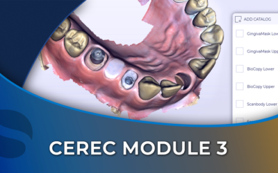 CEREC 03 Acquisition Phase