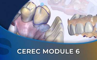 CEREC 06 Case Studies and Troubleshooting