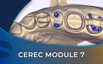 CEREC 07 Mastering Single-Tooth Restorations