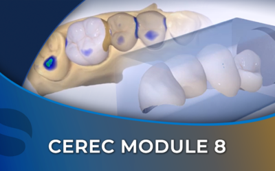 CEREC 08 Bridge Design