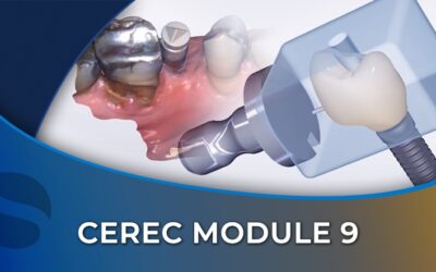 CEREC 09 Implant Restorations
