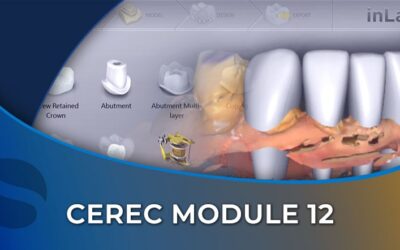 CEREC 12 inLab