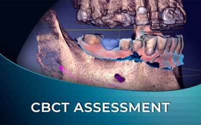 DIW 02 CBCT Assessment and Implant Planning