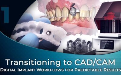 Digital Implant Workflows for Predictable Results
