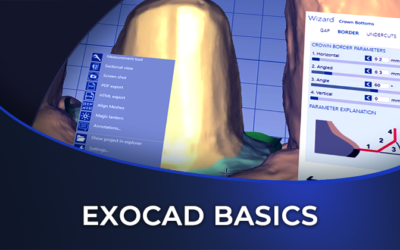 Exocad for Beginners – Tools and Workflow