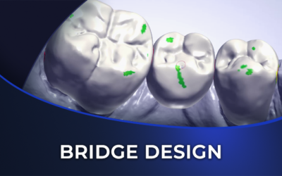 How to Design a Bridge: Key Considerations, Tips & Tricks
