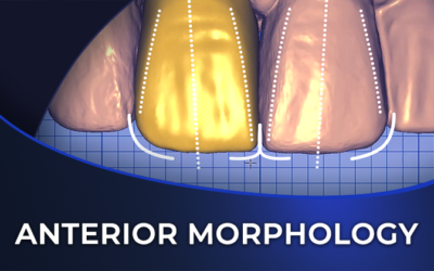 How to Design an Anterior Crown