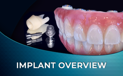 Implant Supported Restorative Solutions