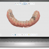 Medit i600 Intraoral Scanner Package - Scanner, Trolley and Laptop - Image 6