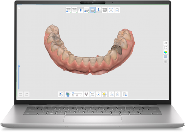 Medit i600 Intraoral Scanner Package - Scanner, Trolley and Laptop - Image 6