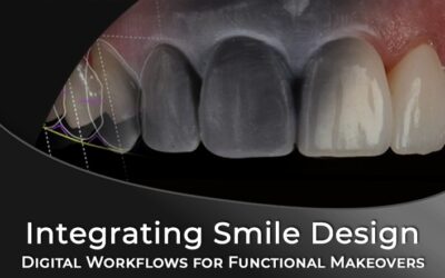 Integrating Digital Smile Design for Functional Makeovers