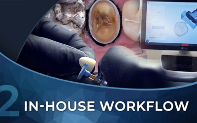 Introduction to the Restorative Workflow