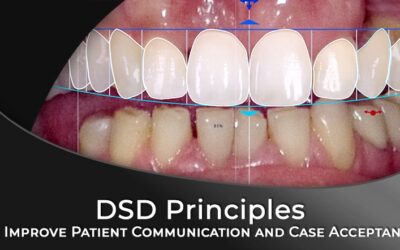 Principles of Digital Smile Design