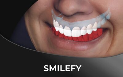 SmileFy – the Newest 3D Digital Smile Design Software