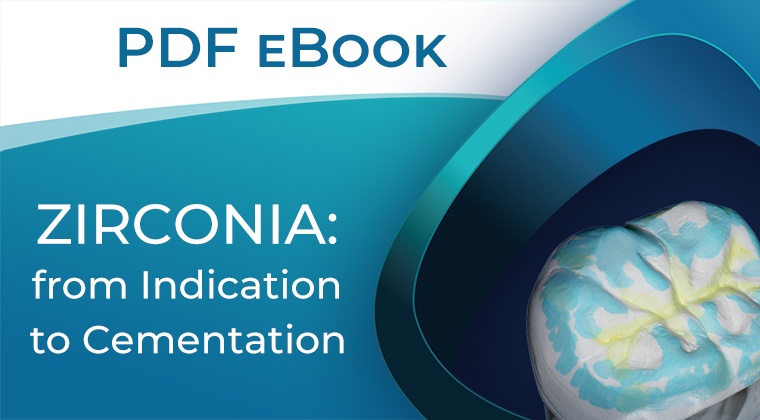 Zirconia Guide from Indication to Cementation eBook PDF